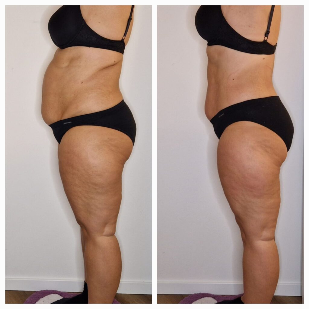 wie funktioniert abnehmen im liegen