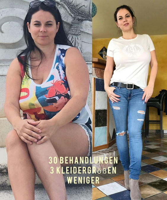 Vorher Nachher 2